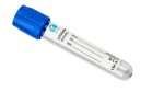 Tubo Tapa Celeste GlobalVac® 4,5 ml 20 Tubos - Imagen 3