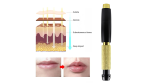 Hyalurón Pen Dual  Tres Potencias  (0.3ml /0.5ml) - Imagen 2