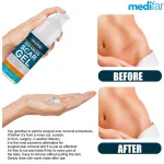 Gel para Cicatrices y Estrías con Retinol y Alantoína 50ml - Imagen 3